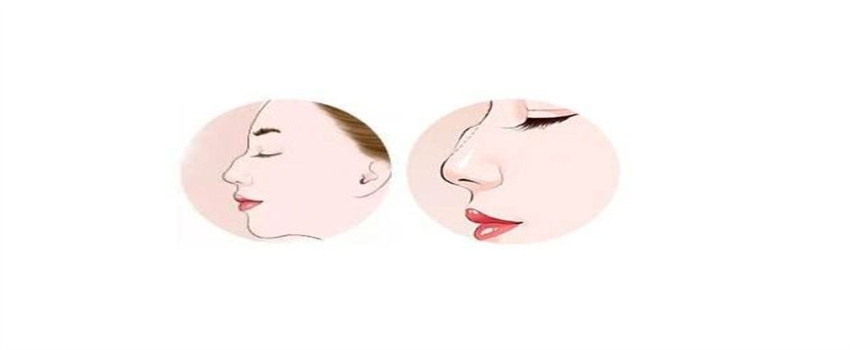 不利于婚姻的鼻子有哪几种（起节鼻，露脊鼻，朝天鼻）