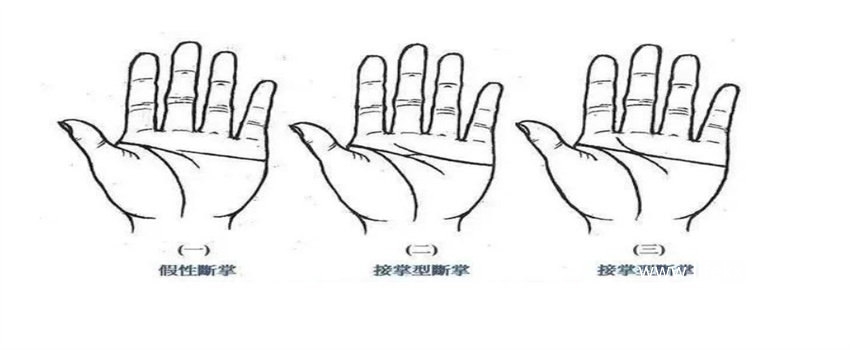 假断掌和真断掌手相的分辨方法（假断掌有智慧线和感情线，真断掌是智慧线和感情线连结）